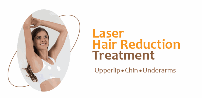 Laser Hair Reduction Treatment — upperlip, chin, underarms